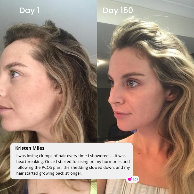 PCOS Reset Plan - 4 Months Personalised Plan to Hormonal Reset